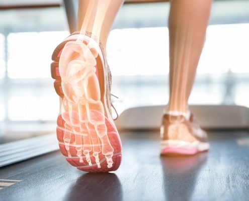 Sportvoeten pedicure praktijk velserbroek Sportvoeten